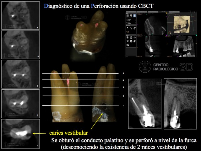centroradiologico 3D. CBCT carestream diagnostico .013